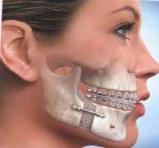 Department of Oral and Maxillofacial Surgery